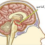 آمنزیای گسسته (فراموشی گسسته )