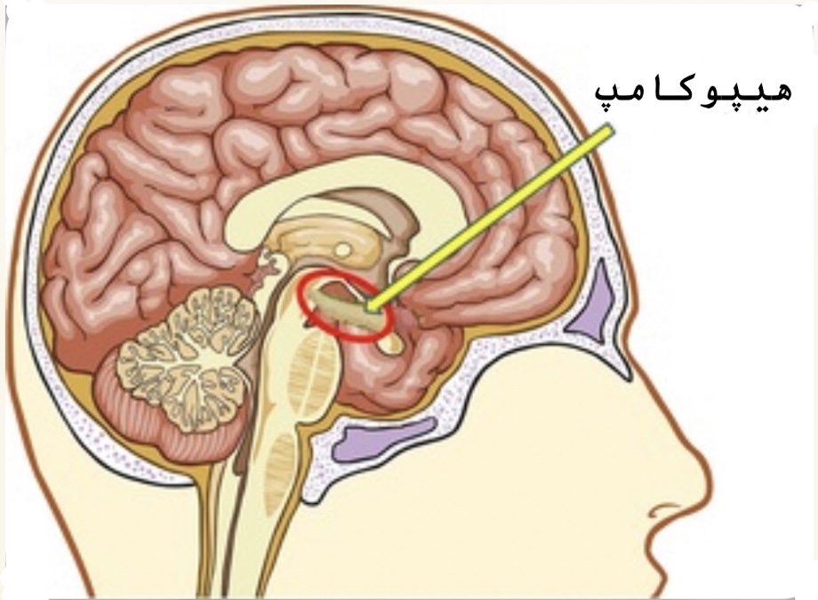 آمنزیای گسسته (فراموشی گسسته )